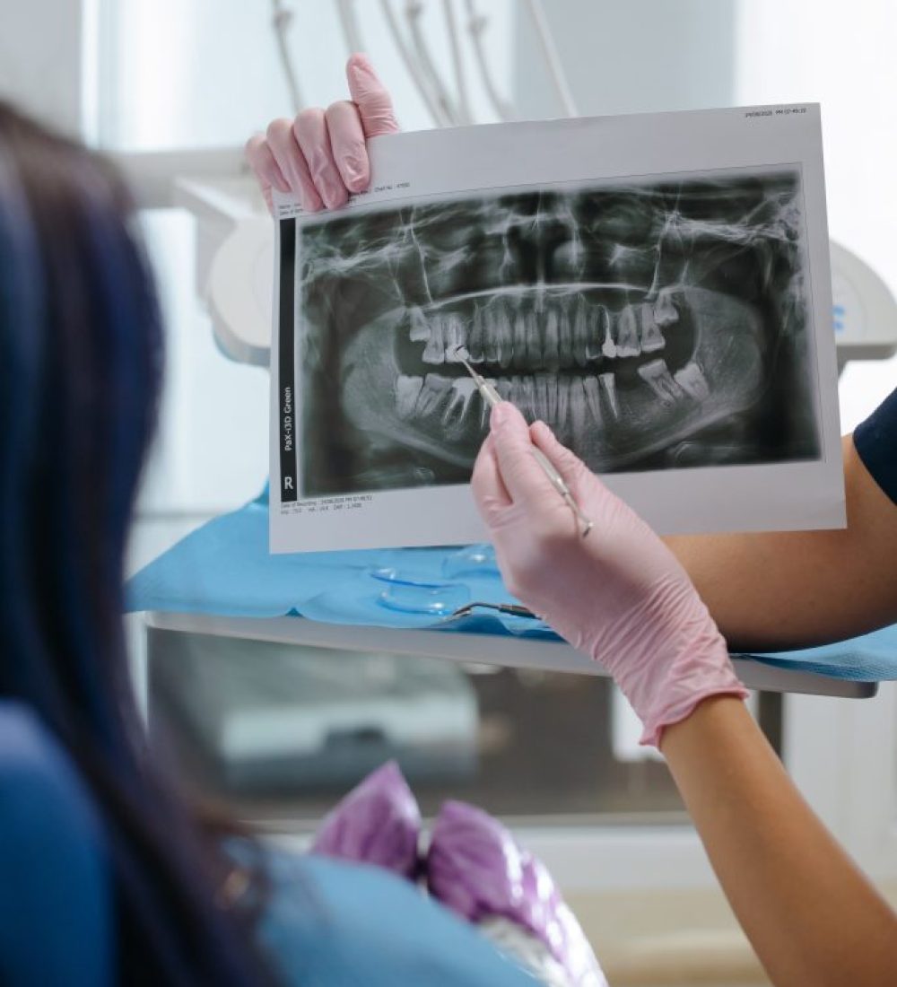 kanal_tedavisi_endodonti_lema_dis_ankara